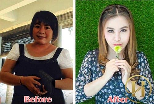 Sau khi nhận ra cân nặng quá khổ có thể làm ảnh hưởng tới sức khỏe cô đã quyết tâm giảm cân