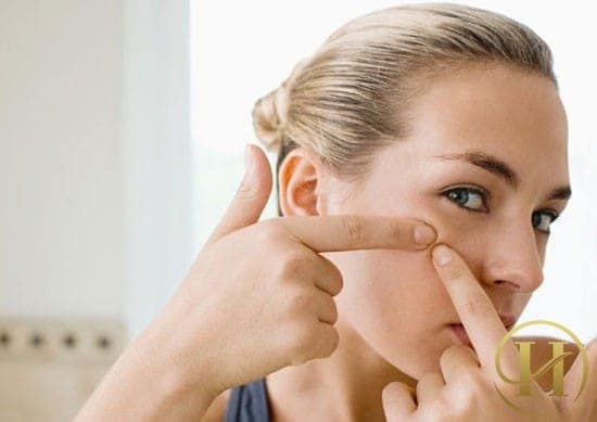 Nhiều người nhầm tưởng mụn thịt là mụn trứng cá nên cố tình nặn mụn