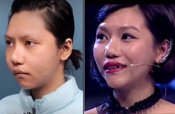 Những diện mạo mới khiến bạn "đứng hình" nhờ phẫu thuật thẩm mỹ