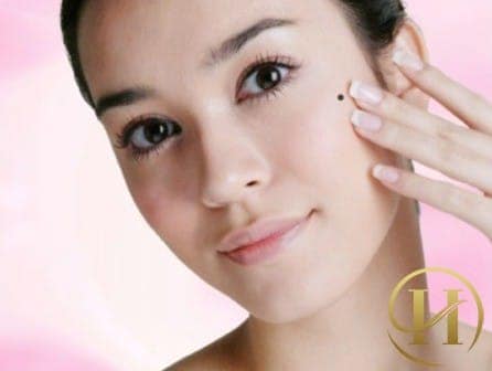 Ở vị trí này nốt ruồi cho biết gan của bạn hoạt động không bình thường 