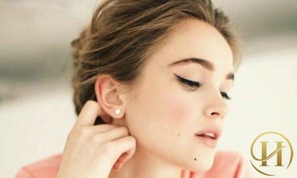 Nốt ruồi ở cằm