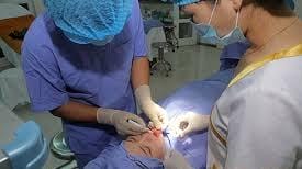  Tiến hành tạo hình môi 