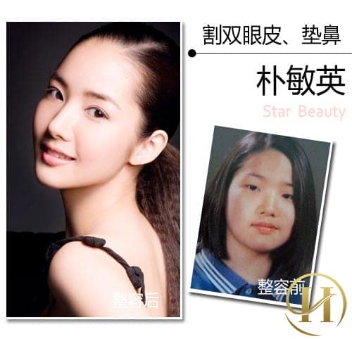 Vẻ đẹp phụ thuộc hoàn toàn vào dao kéo