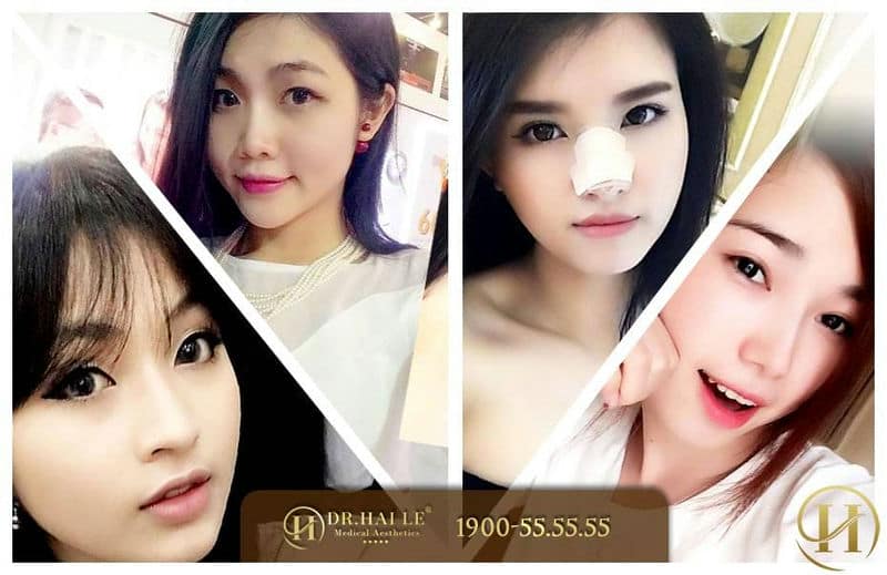Viện thẩm mỹ y khoa Dr. Hải Lê 