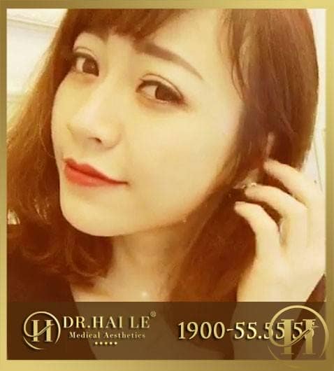 Nhấn mí Thái Lan Deep Eyes có đau không?