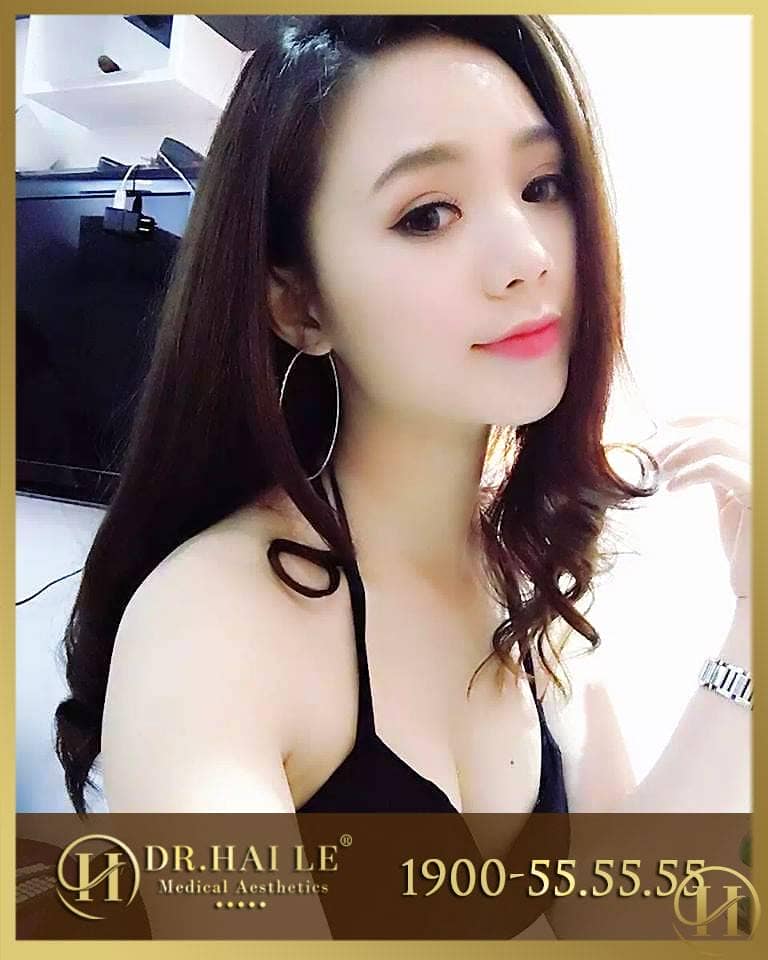 Địa chỉ nâng mũi đẹp an toàn uy tín tại Hà Nội