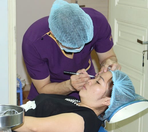  Bước 2: Bác sĩ tiến hành đo vẽ xác định đường mí mắt 