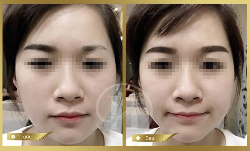 Phun xăm thẩm mỹ Hàn Quốc: Mắt đẹp - Môi xinh - Lông mày phú quý