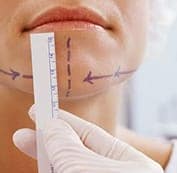  Đo vẽ, tạo hình cằm V-line 