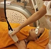  Tiến hành điều trị bằng Laser xung dài Clarity 