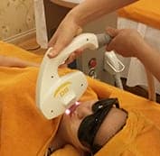  Điều trị bằng Elos. 