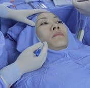  Gây tê tại chỗ để khách hàng cảm thấy thoải và dễ chịu nhất trong quá trình thực hiện 