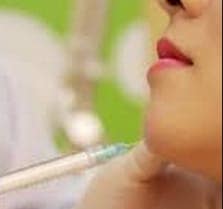  Gây tê vùng cằm 