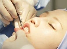  Tiến hành phẫu thuật độn cằm V-line 