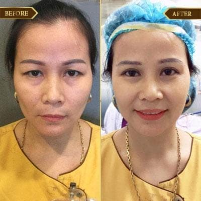 Hồng Vân, 43 tuổi, Hải Phòng