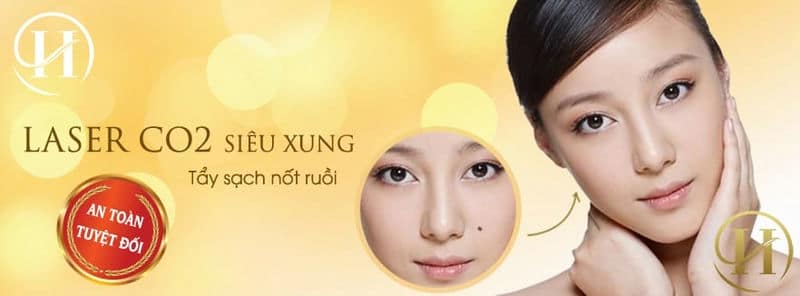 Laser CO2 tẩy nốt ruồi