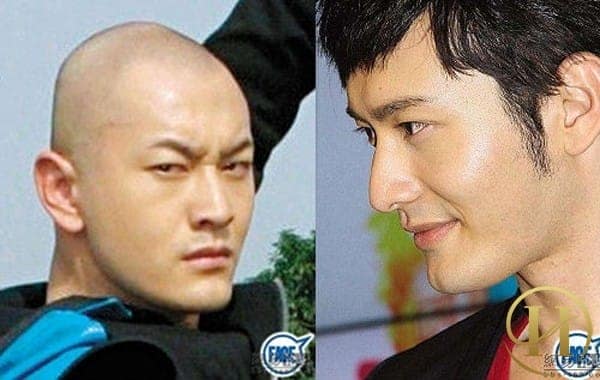 Huỳnh HIểu Minh bị nghi ngờ độn cằm nhưng anh luôn phủ nhận Huỳnh HIểu Minh bị nghi ngờ độn cằm nhưng anh luôn phủ nhận - sao nam Hoa ngữ phẫu thuật thẩm mỹ