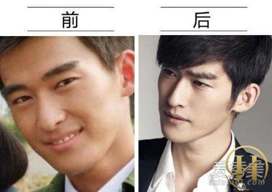 Quan sát ảnh quá khứ và hiện tại của Trương Hàn, nhiều người nghi ngờ anh sửa mũi Quan sát ảnh quá khứ và hiện tại của Trương Hàn, nhiều người nghi ngờ anh sửa mũi
