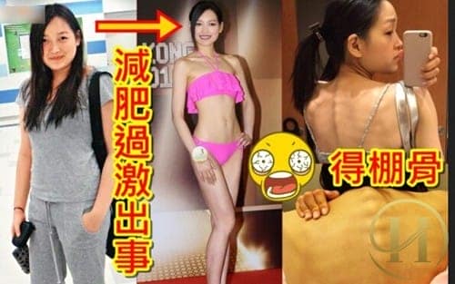 Thí sinh hoa hậu Hong Kong La Đan Hồng nhịn ăn giảm cân