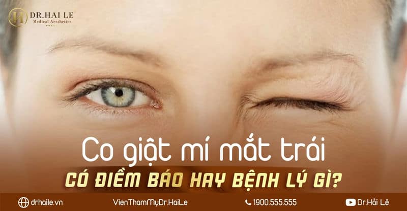 Co giật mí mắt trái có điềm báo hay gặp bệnh lý gì?