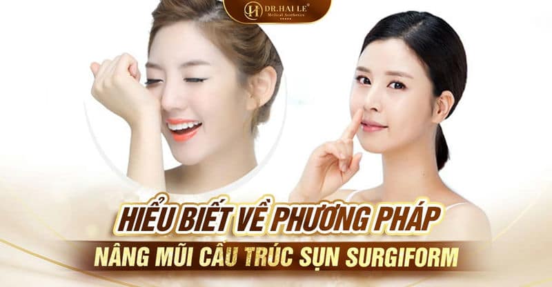 Hiểu biết về phương pháp nâng mũi cấu trúc sụn surgiform