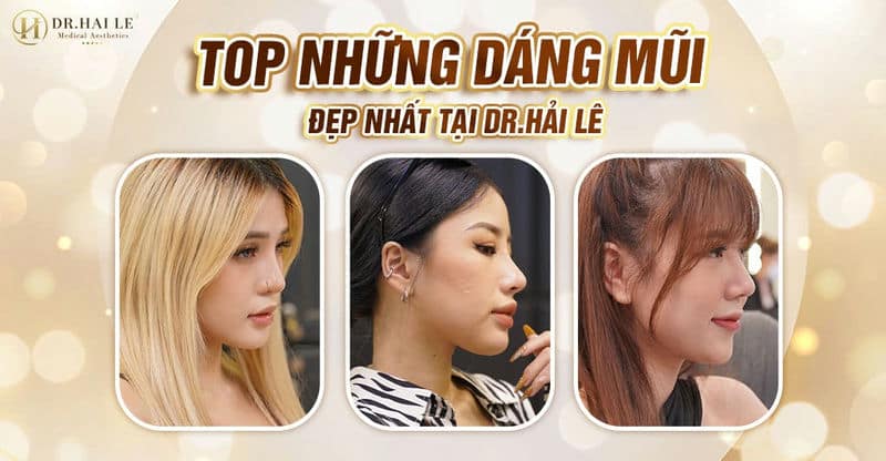 Top những dáng mũi đẹp tự nhiên tại Dr.Hải Lê