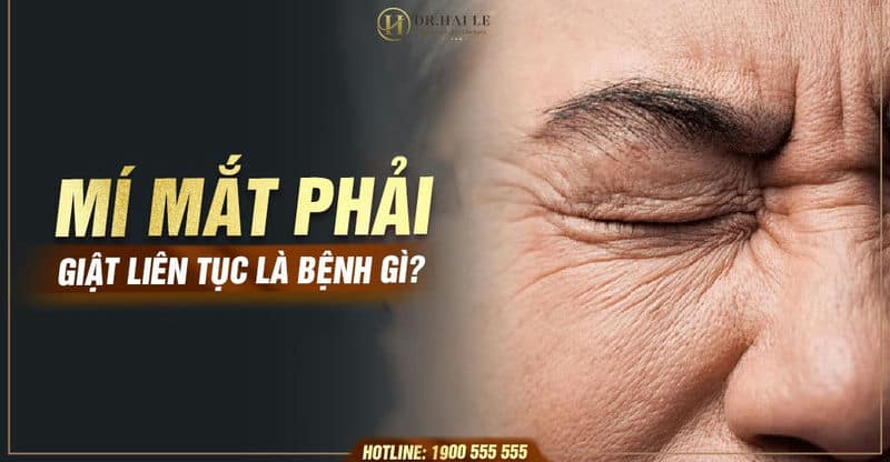 Mí mắt phải giật liên tục là bệnh gì?