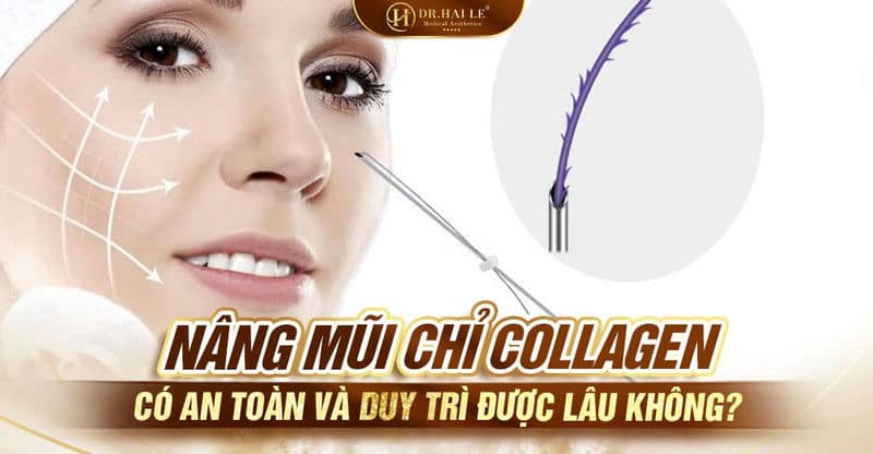 Review quy trình nâng mũi chỉ collagen có duy trì được lâu không?