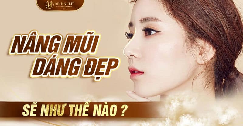 Nâng mũi dáng đẹp sẽ như thế nào?