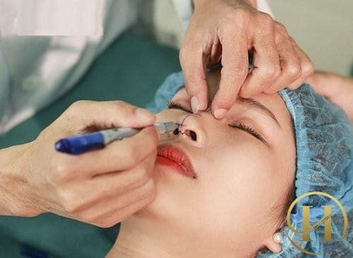 để tránh gặp biến chứng sau nâng mũi, an tâm khi thực hiện nâng mũi, nên lựa chọn địa chỉ uy tín, nơi sở hữu đội ngũ bác sĩ giỏi, đã có giấy phép hành nghề do Bộ Y tế cấp.
