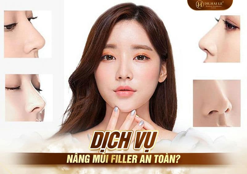 Dịch vụ nâng mũi Filler an toàn?