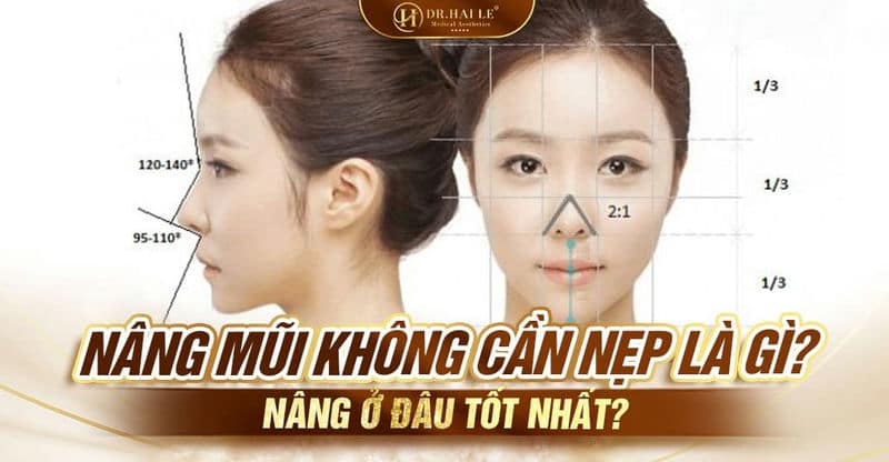 Nâng mũi không cần nẹp là gì? Nâng ở đâu tốt nhất?