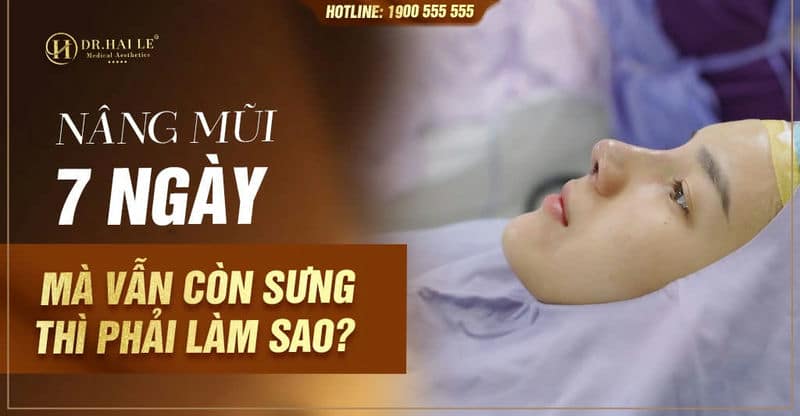 Nâng mũi 7 ngày mà vẫn còn sưng thì phải làm sao?
