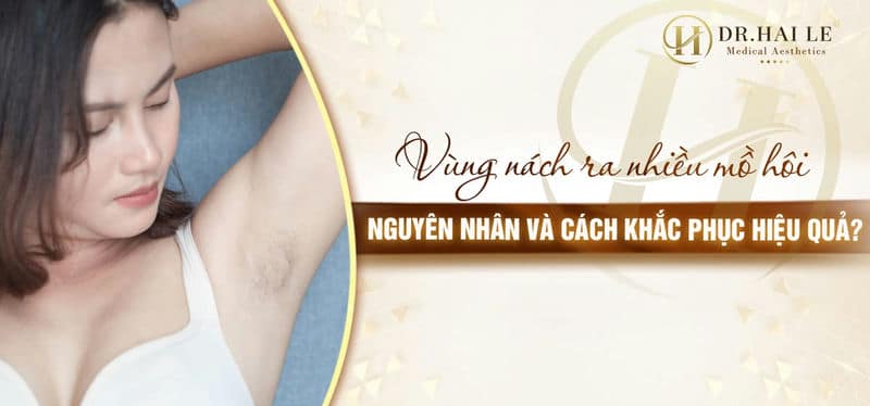 Vùng nách ra nhiều mồ hôi: Nguyên nhân và cách khắc phục hiệu quả?