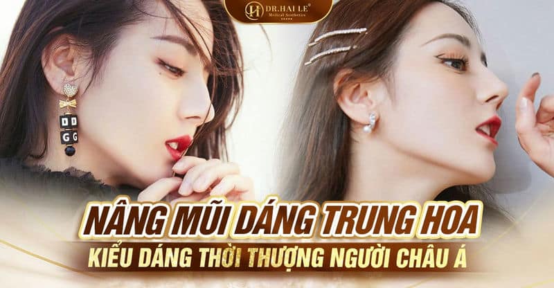 Nâng mũi dáng Trung Hoa - Kiểu dáng thời thượng người Châu Á