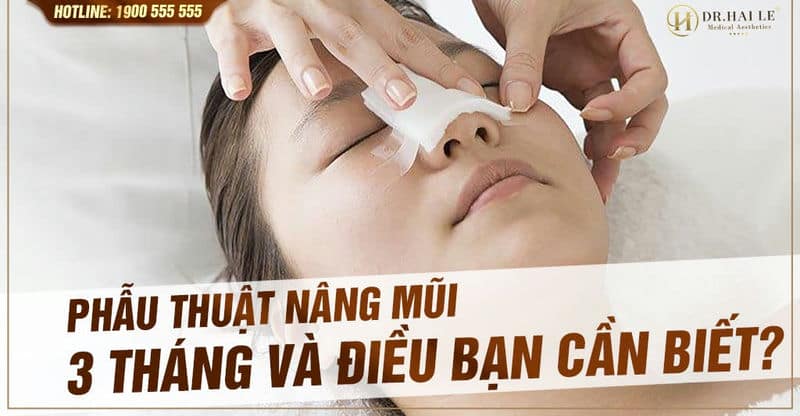 Phẫu thuật nâng mũi sau 3 tháng và điều bạn cần biết?