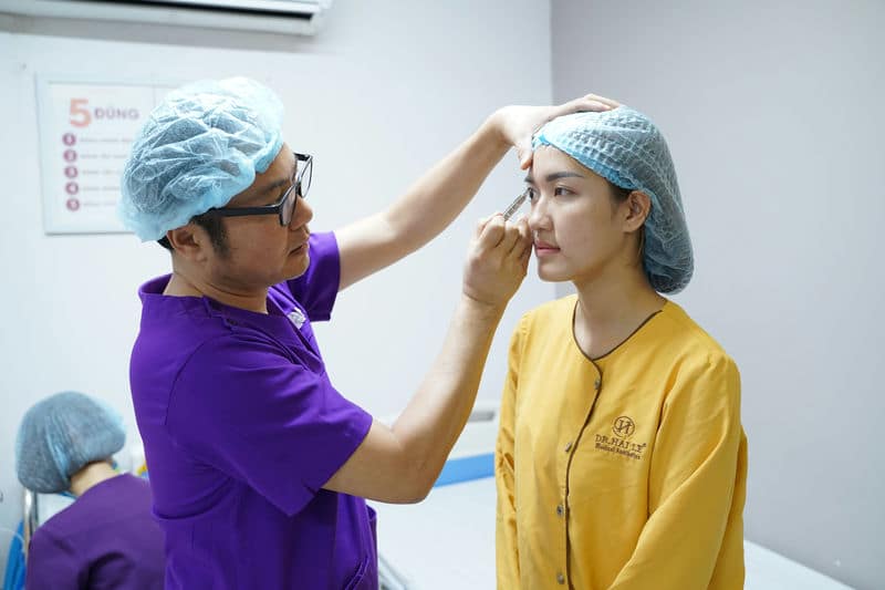  Bước 2: Bác sĩ thăm khám, đo vẽ, tư vấn nếp mí phù hợp 