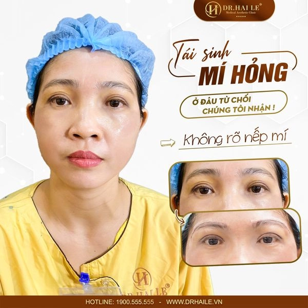cat-mi-khong-dau-don