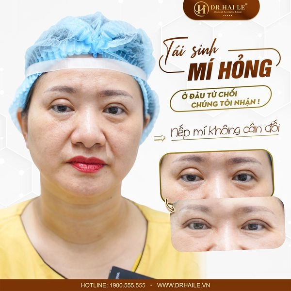 Cat-mi-khong-gay-dau