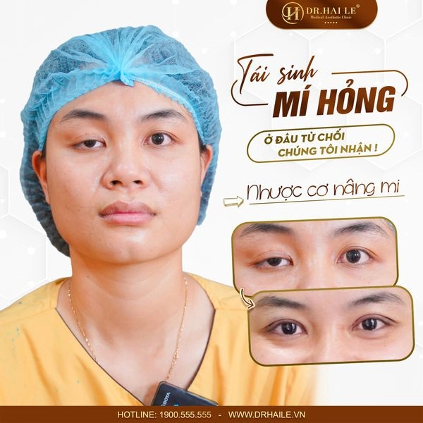 mi-cat-khong-dau-don