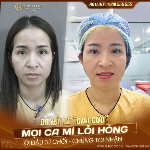 sua-mi-khong-phai-nghi-ngoi
