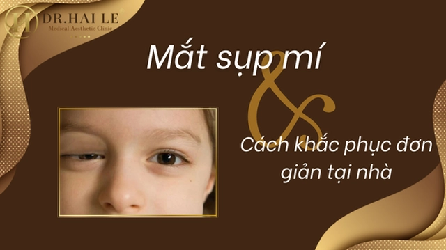 cach-chua-sup-mi-mat-don-gian-tai-nha-1