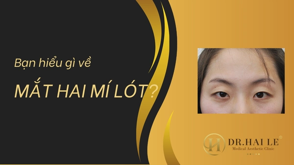 Giải mã: mắt 2 mí lót là như thế nào?
