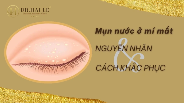 mun-nuoc-o-mi-mat