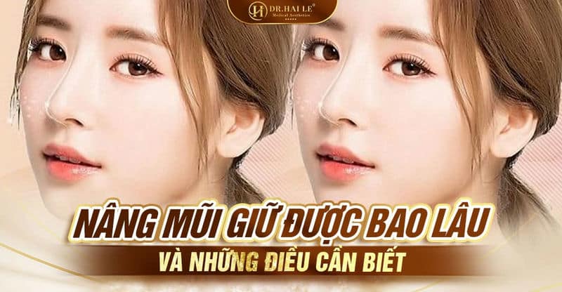 Nâng mũi giữ được bao lâu và những điều cần biết?