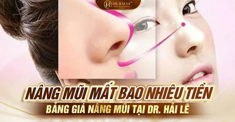 Nâng mũi mất bao nhiêu tiền - Bảng giá nâng mũi tại DR. Hải Lê
