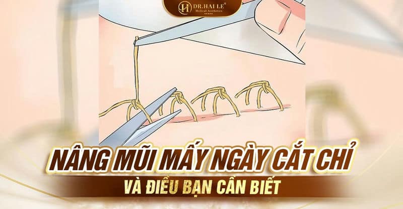 Nâng mũi mấy ngày cắt chỉ và điều bạn cần biết