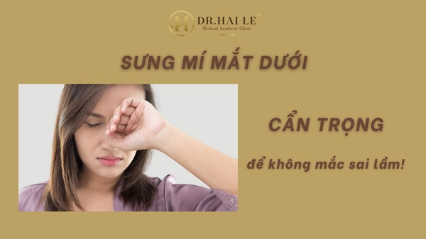 Sưng mí mắt dưới - Cẩn trọng để không mắc sai lầm!