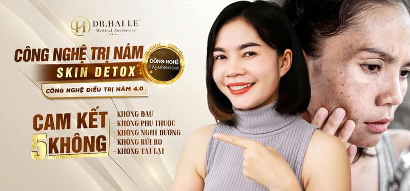 Công nghệ trị nám Skin Detox – Công nghệ điều trị nám 4.0