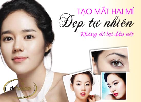  Cắt mắt 2 mí ở đâu đẹp nhất 3